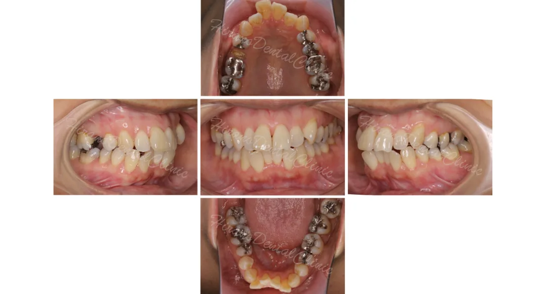 253 エコノミー・オーソペディクス非抜歯床矯正pooによる顎態調和法 253 エコノミー・オーソペディクス非抜歯床矯正pooによる顎態調和法 253